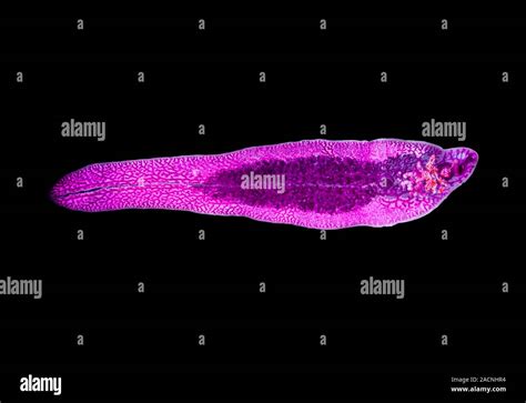  Sheep Liver Fluke:  A Tiny Trematode Terrorizing Sheep Livers Across the Globe!